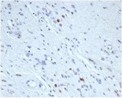 Myogenin Mouse anti-Human, Clone: rMYOG/6297, Novus Biologicals 100 &mu;g | Buy Online | Novus Biologicals | Fisher Scientific